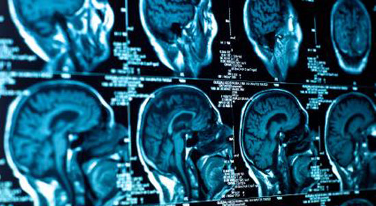 FLUORIDE & IQ: 76 STUDIES